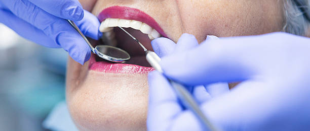 Best Emergency Dental Care for Broken or Chipped Teeth in Philmont, NY